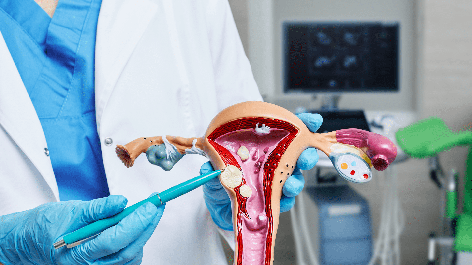 understanding fibroids